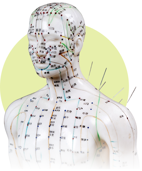 Acupuncture Therapy Mississauga at Award winning Integrated wellness clinic - Innova integrated wellness