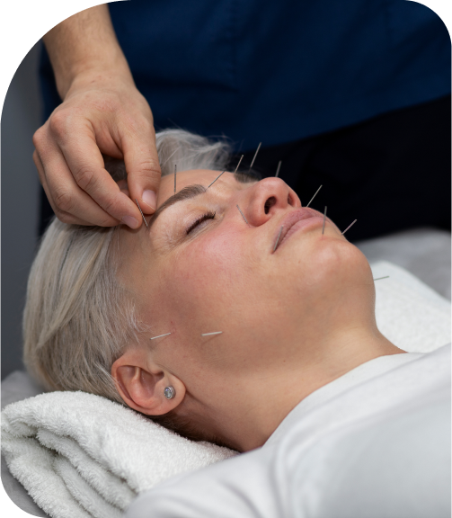 As a licensed Traditional Chinese Medicine (TCM) Registered Acupuncturist in Mississauga