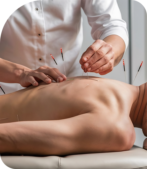 Every Acupuncture session is tailored to your concerns