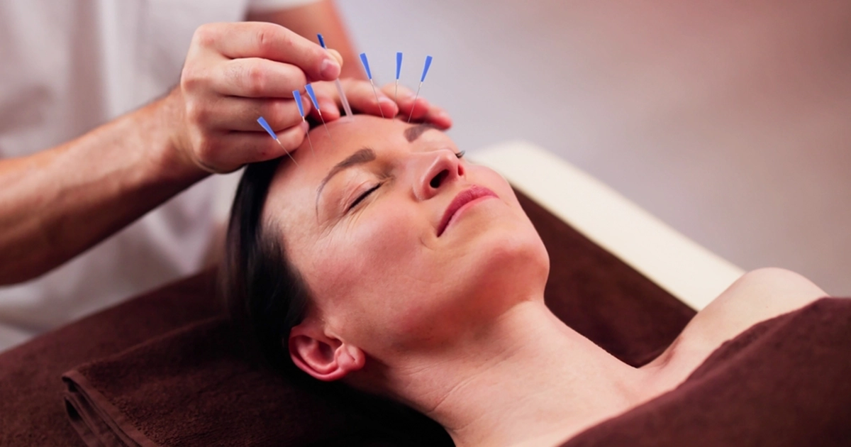 Holistic Health and Wellness - Acupuncture in Mississauga