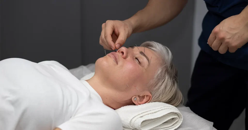 Acupuncture is one of those options, and it has a considerably stronger evidence base for anxiety and stress than most people expect.