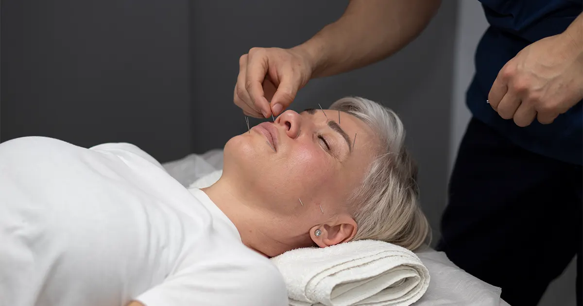 Acupuncture is one of those options, and it has a considerably stronger evidence base for anxiety and stress than most people expect.